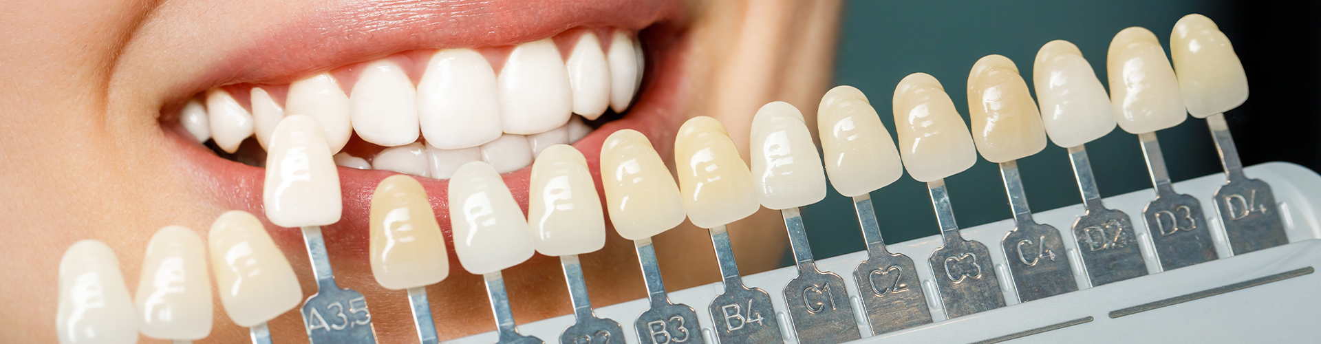 Tooth shade-matching tool next to woman's smile.